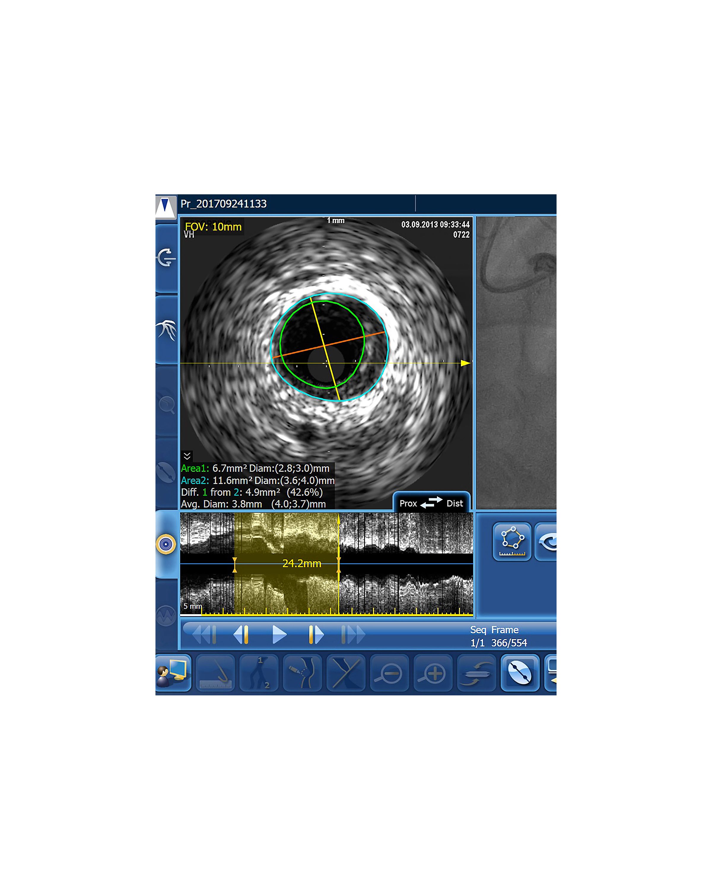 ultrasound